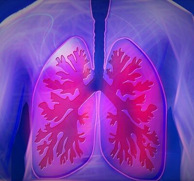 the lungs, which are affected by pneumonia